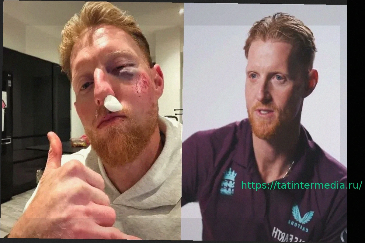 Preview Капитан сборной Англии Бен Стоукс рассказал о страшной травме, которая едва не завершила его карьеру, и подтвердил свое возвращение